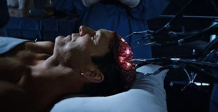 Agent Coulson Surgery